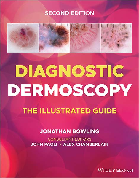 DIAGNOSTIC DERMOSCOPY - THE ILLUSTRATED GUIDE, 2E